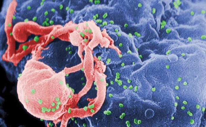 Sejarah HIV AIDS Pengertian Asal usul Dan Perkembangannya Sejarah hiv aids pengertian asal usul dan perkembangannya