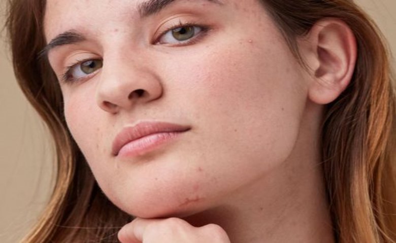 review the ordinary niacinamide