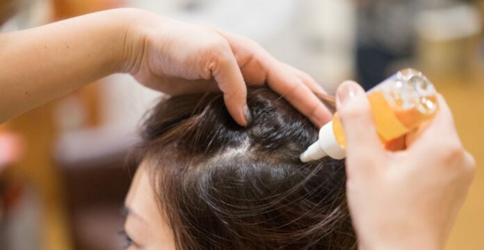 11 Hair To   nic Terbaik: Atasi Rontok, Rambut pun Sehat dan