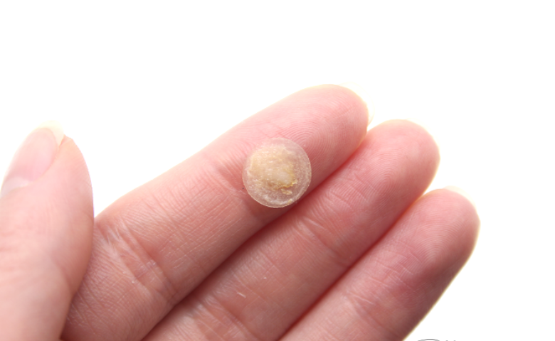Pimple patch
