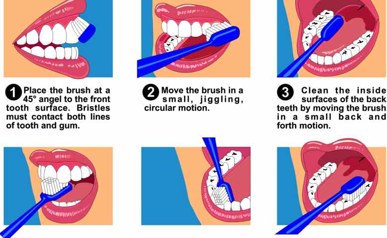 Cara Nak Menggosok Gigi Yang Benar Beserta Gambarnya