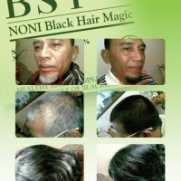 Distributor RESMI BSY Shampo Noni (Penghitam Rambut Hanya Dalam 10 Menit).Termurah,Asli,&Aman