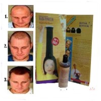 Jual OBAT PENUMBUH RAMBUT BOTAK PALING AMPUH SEKALI OLES LEBAT PANJANG Murah