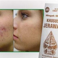 Minyak Oles Khusus Jerawat Cap Wayang OriginaL ASLI termurah