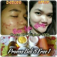 Jual Cream HN Ori Hetty Nugrahati 100% Original | Krim Pemutih Wajah Aman Murah
