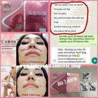Jual NOSE UP 3D Murah