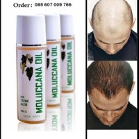 Minyak Kemiri Obat Alami Penumbuh Rambut Cepat Seperti Green angelica