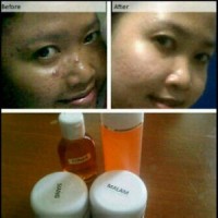 Paket Cream Syahrini Ampuh Pemutih Wajah Penghilang Jerawat Batu