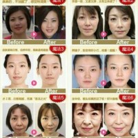 ION FACE MASSAGER/Setrika wajah tirus
