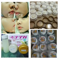 Jual PAKET PERAWATAN WAJAH KEFIR SUSU KAMBING GLOW Murah