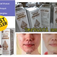 Minyak Oles Jerawat Merk Wayang / Obat Jerawat Wayang BPOM