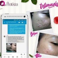 Jual Paket Cream Penghilang Bopeng atau Obat Lubang Bekas Jerawat dan Cacar Murah
