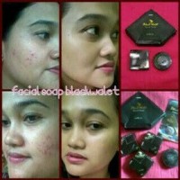 Jual ORI ASLI 100% black walet Sabun herbal blackwalet kecantikan Murah