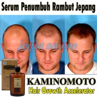 Jual Kaminomoto hair growth accelerator serum jepang penghilang kebotakan Murah