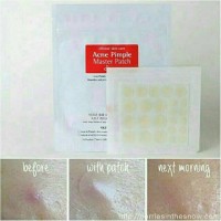 Jual COSRX Acne Pimple Master Patch Murah