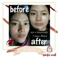 KEFIR MASK ETAWA masker herbal organik green tea teh hijau herbeauty