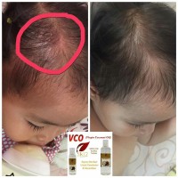 VCO MINYAK KELAPA rambut urang aring lavender clay jaman dulu barbara