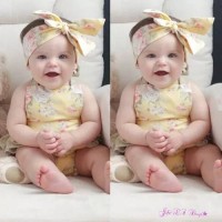 Jual Jumpsuit bayi import floral print set bandana #Kuning Murah