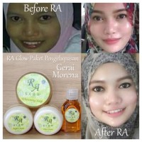 Jual RA GLOW (PAKET PENGELUPASAN) /CREAM PEMUTIH WAJAH RACIKAN DOKTER Murah