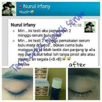 Ertos Eyelash Serum Pelentik Bulu Mata Termurah