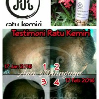 Jual Minyak Kemiri Penumbuh Rambut Botak Hair Regrowth Treatment Murah