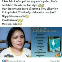 Jual ion silver Murah