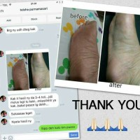 Jual Muby Baby Foot B12 Royal Jelly Original 1 pabrik Hanaka jamin kelupas Murah