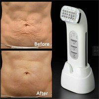 RADIO FREQUENCY LIFTING ALAT GALVANIC THERMAGE SETRIKA WAJAH