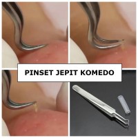 Jual Pembersih Komedo - Pinset Komedo - BlackHead Tweezer - Penjepit Komedo Murah