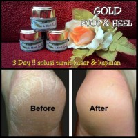 Jual cream gold foot & heels untuk kaki pecah pecah Murah