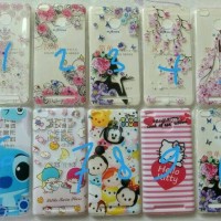 Jual Softcase Xiaomi Redmi 3X/3 Pro/3S - Gadget Unik 78 Murah