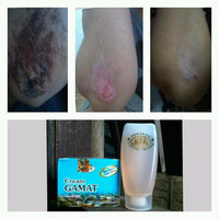Jual TERLARIS TERLARIS CREAM GAMAT + FACIAL WASH HPA Murah