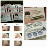 Jual VACUM KOMEDO / ALAT SEDOT KOMEDO Murah