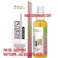 Jual Mengobati Kebotakan Rambut - Obat Untuk Kebotakan - Obat Ant Murah