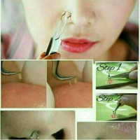 Jual Blackhead tweezer / pinset alat pencabut komedo acne alat stainless I Murah