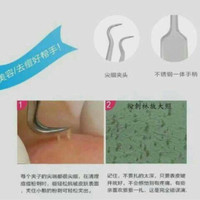Jual Pinset Komedo Original Murah