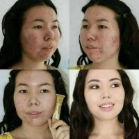 Jual Dermacol Murah