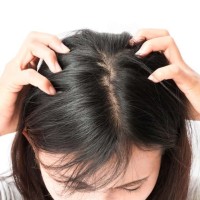 Shampo penghilang kutu rambut