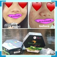 Sabun walet ALOEVERA by Asyifa Lani berBPOM / Pemutih wajah/pemutih
