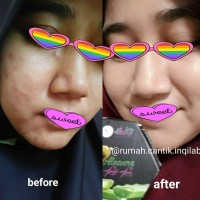 HAL Sabun walet aloevera Heny Asyifa Lany wajah badan hitam black