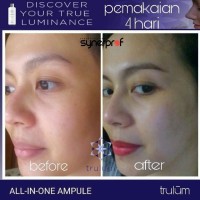Jual Trulum Skincare 15ml Asli Original ! Pemutih Wajah Aman dan Ampuh Murah