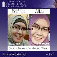 Jual Trulum 15ml/5ml/120ml | Pemutih Wajah Aman 100% HALAL BPOM Terlaris Murah