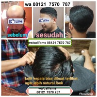wig pria toupee rambut palsu asli 100% remy human hair replacement