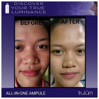 Pengencang dan Pelembab Kulit Wajah | Trulum Spray 15ml