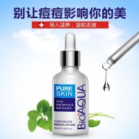 T2105 Bioaqua Serum Wajah Anti Jerawat Penghilang Bekas Jerawat Blemis