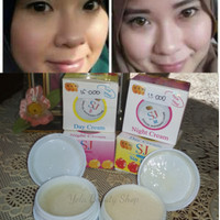 Krim pemutih wajah SJ