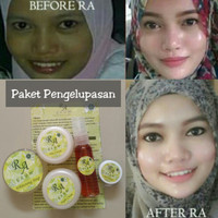 Jual RA GLOW (PAKET PENGELUPASAN) /CREAM PEMUTIH WAJAH RACIKAN DOKTER Murah