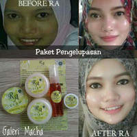 Jual RA GLOW (PAKET PENGELUPASAN) /CREAM PEMUTIH WAJAH RACIKAN DOKTER Murah