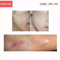 Meilibahenling Lotion Minyak Ular - Lotion Penghilang Bekas Luka