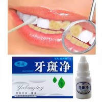 Whitening Cara Memutihkan GIGI palsu Kuning, Pemutih GIGI permanen